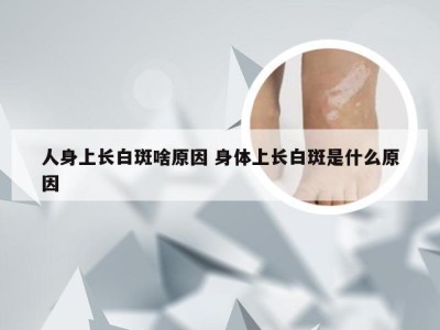 人身上长白斑啥原因 身体上长白斑是什么原因