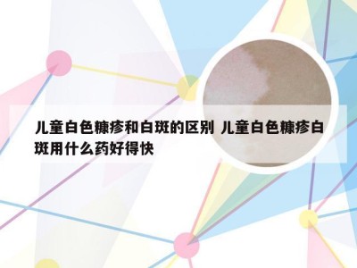 儿童白色糠疹和白斑的区别 儿童白色糠疹白斑用什么药好得快