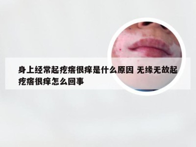 身上经常起疙瘩很痒是什么原因 无缘无故起疙瘩很痒怎么回事