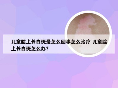 儿童脸上长白斑是怎么回事怎么治疗 儿童脸上长白斑怎么办?