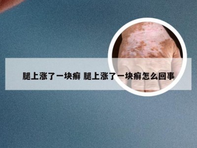 腿上涨了一块癣 腿上涨了一块癣怎么回事