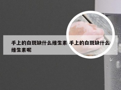 手上的白斑缺什么维生素 手上的白斑缺什么维生素呢