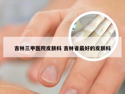 吉林三甲医院皮肤科 吉林省最好的皮肤科