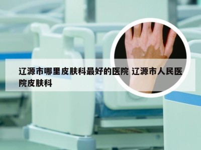 辽源市哪里皮肤科最好的医院 辽源市人民医院皮肤科