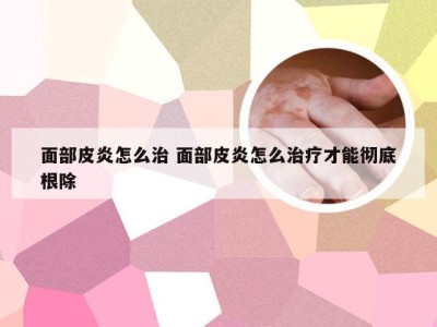 面部皮炎怎么治 面部皮炎怎么治疗才能彻底根除