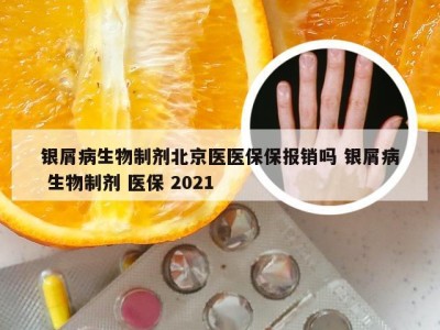 银屑病生物制剂北京医医保保报销吗 银屑病 生物制剂 医保 2021