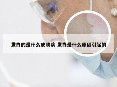 发白的是什么皮肤病 发白是什么原因引起的