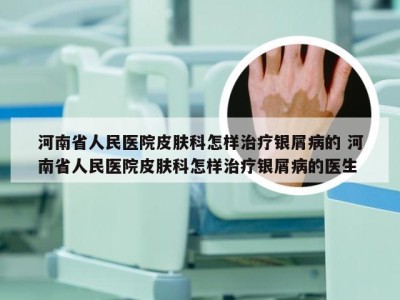 河南省人民医院皮肤科怎样治疗银屑病的 河南省人民医院皮肤科怎样治疗银屑病的医生