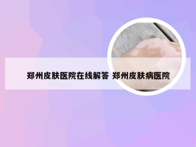 郑州皮肤医院在线解答 郑州皮肤病医院