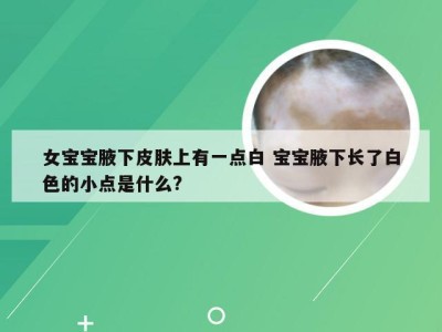 女宝宝腋下皮肤上有一点白 宝宝腋下长了白色的小点是什么?