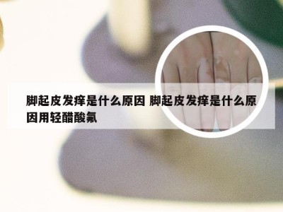 脚起皮发痒是什么原因 脚起皮发痒是什么原因用轻醋酸氟