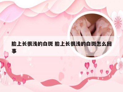 脸上长很浅的白斑 脸上长很浅的白斑怎么回事