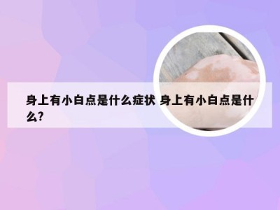 身上有小白点是什么症状 身上有小白点是什么?