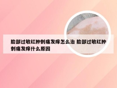 脸部过敏红肿刺痛发痒怎么治 脸部过敏红肿刺痛发痒什么原因