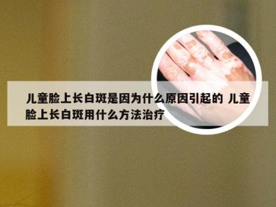 儿童脸上长白斑是因为什么原因引起的 儿童脸上长白斑用什么方法治疗