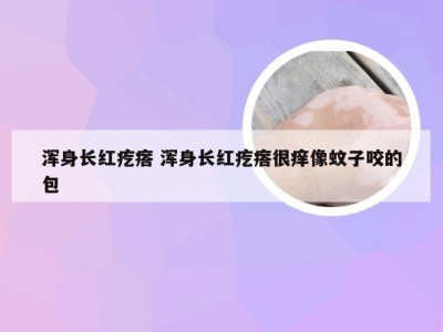 浑身长红疙瘩 浑身长红疙瘩很痒像蚊子咬的包