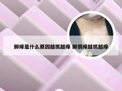 脚痒是什么原因越抓越痒 脚很痒越抓越痒