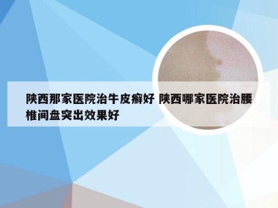 陕西那家医院治牛皮癣好 陕西哪家医院治腰椎间盘突出效果好