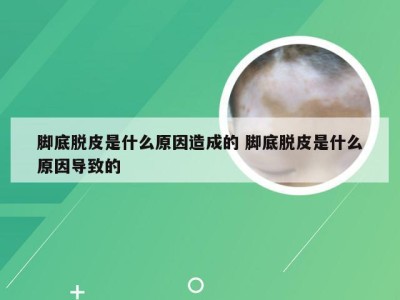 脚底脱皮是什么原因造成的 脚底脱皮是什么原因导致的