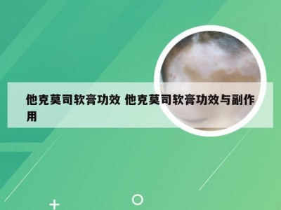 他克莫司软膏功效 他克莫司软膏功效与副作用