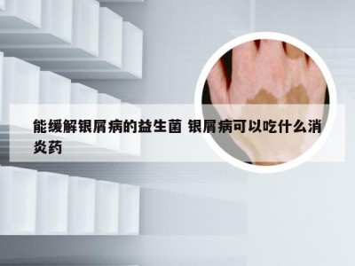 能缓解银屑病的益生菌 银屑病可以吃什么消炎药