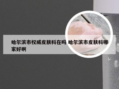 哈尔滨市权威皮肤科在吗 哈尔滨市皮肤科哪家好啊