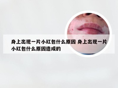 身上出现一片小红包什么原因 身上出现一片小红包什么原因造成的