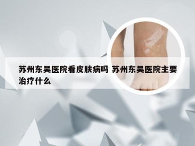 苏州东吴医院看皮肤病吗 苏州东吴医院主要治疗什么