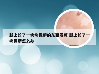 腿上长了一块块像癣的东西发痒 腿上长了一块像癣怎么办