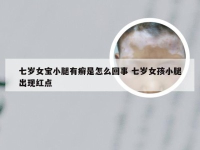 七岁女宝小腿有癣是怎么回事 七岁女孩小腿出现红点