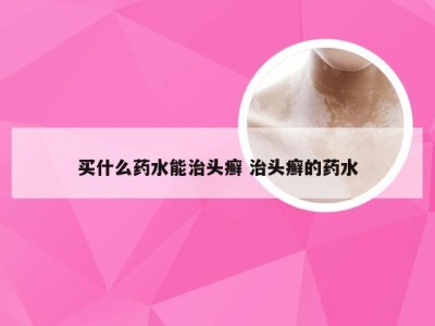 买什么药水能治头癣 治头癣的药水