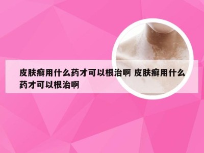 皮肤癣用什么药才可以根治啊 皮肤癣用什么药才可以根治啊