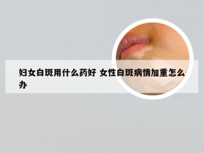 妇女白斑用什么药好 女性白斑病情加重怎么办