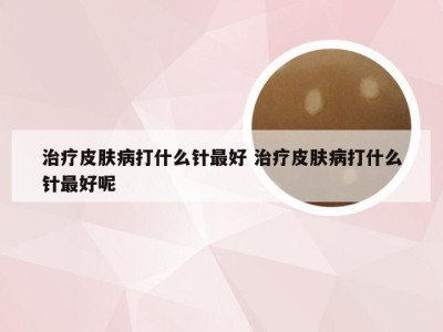 治疗皮肤病打什么针最好 治疗皮肤病打什么针最好呢