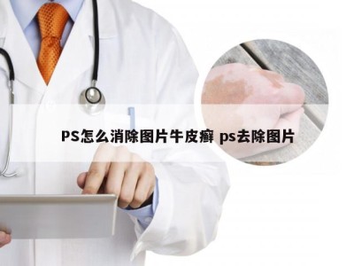 PS怎么消除图片牛皮癣 ps去除图片