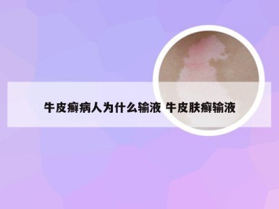 牛皮癣病人为什么输液 牛皮肤癣输液