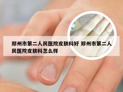 郑州市第二人民医院皮肤科好 郑州市第二人民医院皮肤科怎么样