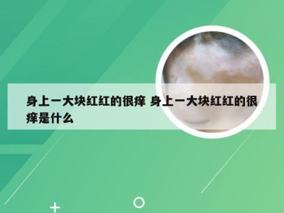 身上一大块红红的很痒 身上一大块红红的很痒是什么