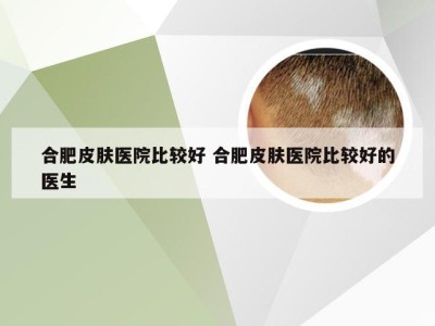 合肥皮肤医院比较好 合肥皮肤医院比较好的医生