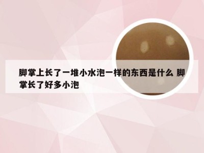 脚掌上长了一堆小水泡一样的东西是什么 脚掌长了好多小泡