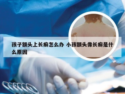 孩子额头上长癣怎么办 小孩额头像长癣是什么原因