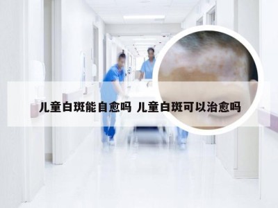 儿童白斑能自愈吗 儿童白斑可以治愈吗