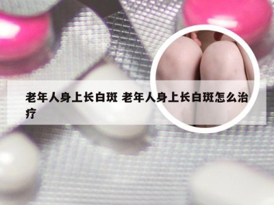 老年人身上长白斑 老年人身上长白斑怎么治疗