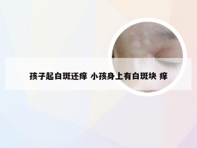 孩子起白斑还痒 小孩身上有白斑块 痒