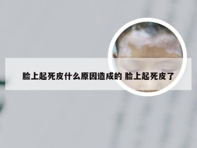 脸上起死皮什么原因造成的 脸上起死皮了