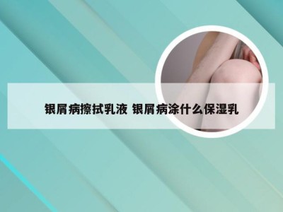 银屑病擦拭乳液 银屑病涂什么保湿乳