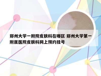 郑州大学一附院皮肤科在哪区 郑州大学第一附属医院皮肤科网上预约挂号