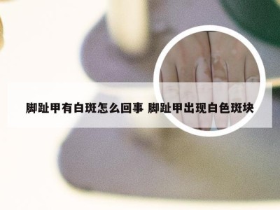 脚趾甲有白斑怎么回事 脚趾甲出现白色斑块