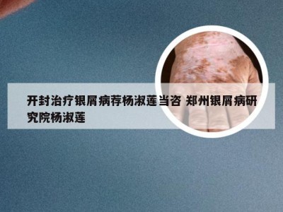 开封治疗银屑病荐杨淑莲当咨 郑州银屑病研究院杨淑莲