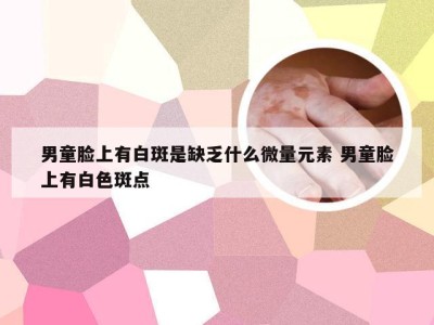 男童脸上有白斑是缺乏什么微量元素 男童脸上有白色斑点